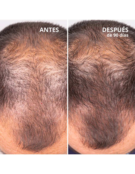 Freshly Hair Growth & Density Treatment 50 ml