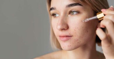 Elimina las manchas y cicatrices del acné: Consejos y Productos