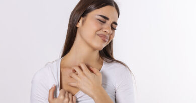 sarpullido por calor en cuello de una mujer