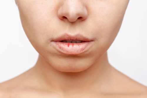 productos para el cuidado de los labios