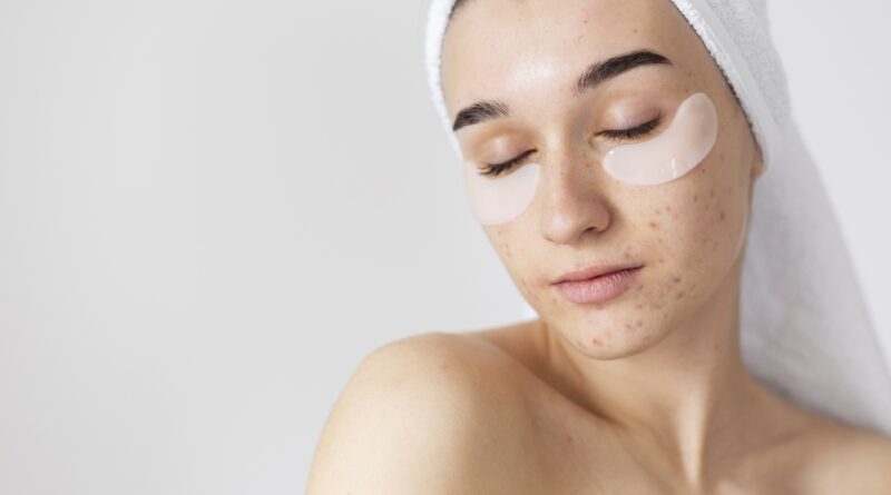 Acne facial