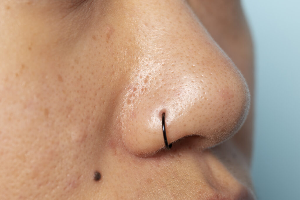piercings en la nariz infectados
