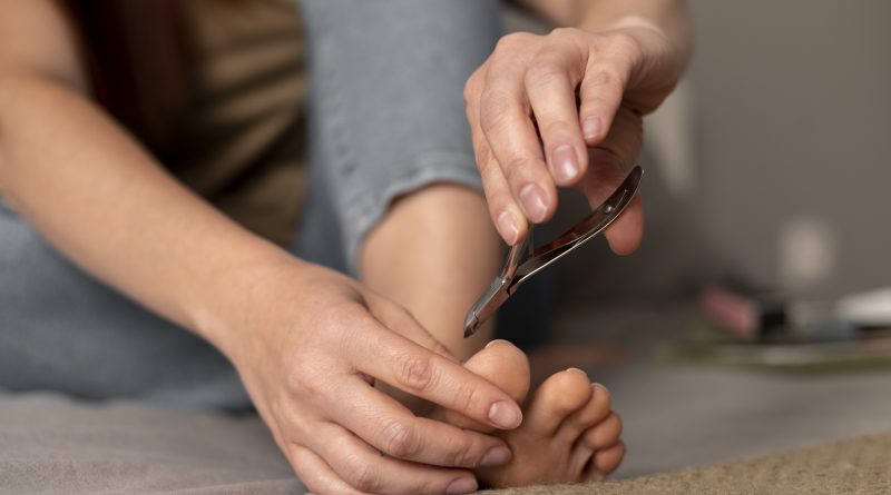 Hongos en las Uñas de los Pies